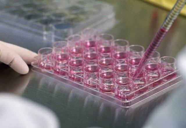 انجام مطالعات سلول درمانی اختلالات تولیدمثلی در زنان توسط محققان ابن سینا