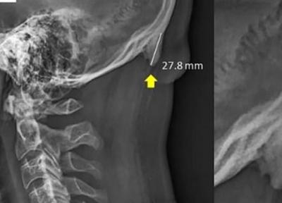 اسکلت پوشیدنی از راه رسید