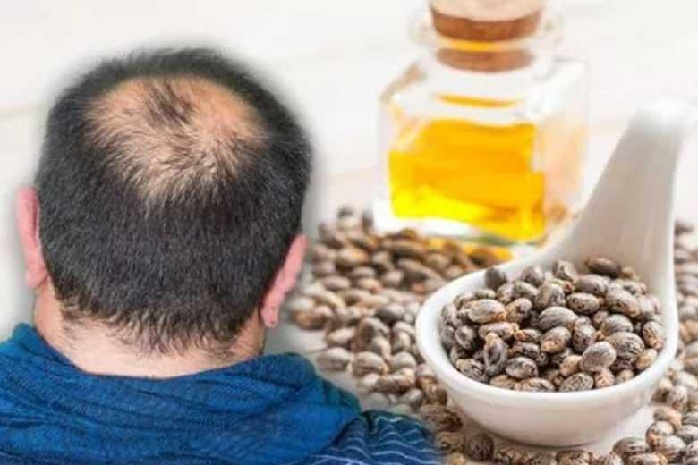 درمان ریزش مو با یک روغن گیاهی درمان ریزش مو با یک روغن گیاهی