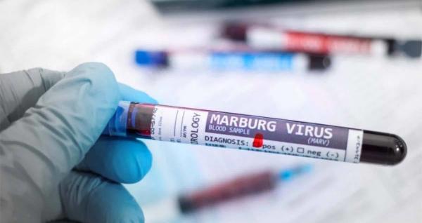 شیوع ویروس ماربورگ در تانزانیا